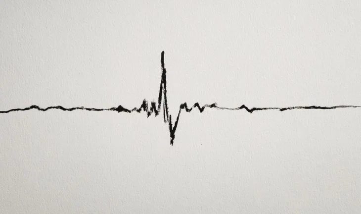 a pulse line showing a peak and then nothing